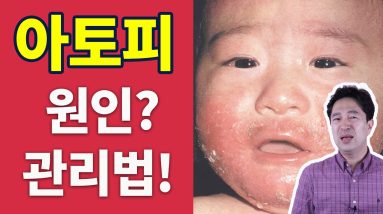 아토피 치료방법, 자녀를 직접 관리 성공해본 경험담! 한번 꼭 들어보세요... by 핑피박 6 1683431445 maxresdefault