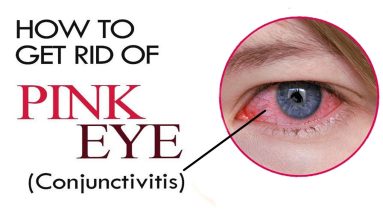 How to Get Rid of Pink Eye | Conjunctivitis Treatment | Home Remedies for Pink Eye Treatment 4 1683435126 maxresdefault