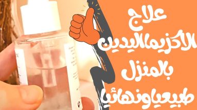 افضل علاج الاكزيما اليدين بالمنزل طبيعيا و نهائيا ونصائح 4 1683589060 maxresdefault