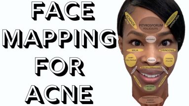 Face Mapping For Acne 18 1683618578 maxresdefault