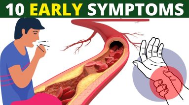 10 Early Symptoms Of Heart Failure 16 1683813498 maxresdefault