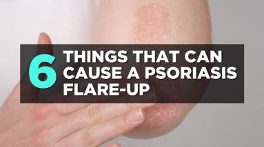 6 Things That Can Cause a Psoriasis Flare Up | Health 10 1683839115 maxresdefault