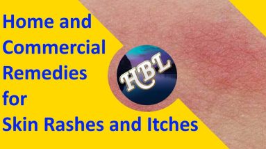 Home and Commercial Remedies for Skin Rashes and Itches 8 1683909089 maxresdefault