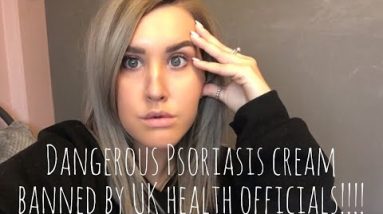 is yinganerjing cream a cure for psoriasis 8 1684005029 hqdefault