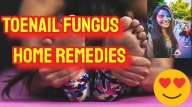 Toenail fungus home remedies | Holistic Natural Cures 18 1684149054 maxresdefault