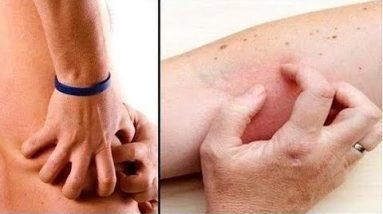 If your kidney is in danger the body will give you these 8 signs , Do not ignore it and share 4 1684229904 hqdefault