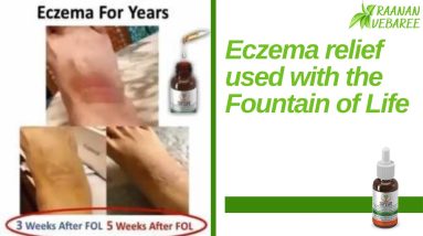 Eczema relief used with the Fountain of Life 14 1684811386 maxresdefault