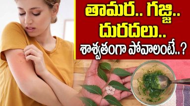 తామర, గజ్జి, దురదలు వెంటనే తగ్గాలంటే I Home Remedies For Ringworm Telugu I Everything in Telugu 18 1684839466 maxresdefault
