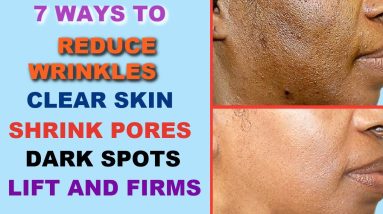 7 Ways To Clear Dark Spots, Lift and Firms, Shrink Large Pores, Lighten The Skin 2 1684855399 maxresdefault