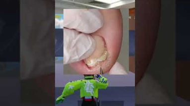 1685350416 hqdefault