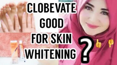 Clobevate cream benefits|clobevate uses in urdu ||skin whitening||acne||eczema@Beautywithknowledge 10 1685463395 maxresdefault