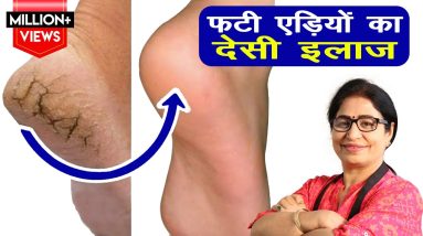 क्या आप भी फटी एड़ियों से परेशान है ? अब 1 ही रात में पाये फटी एड़ियों से छुटकारा | Homemade Cream 4 1685640204 maxresdefault