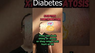 1685959027 maxresdefault