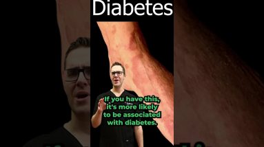 1686128003 maxresdefault