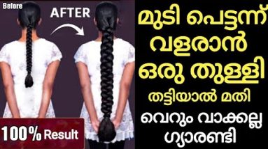 മുടി പെട്ടന്ന് നീണ്ടു വളരാൻ ഇത് ഒരു തുള്ളി തലയിൽ തട്ടിയാൽ മതി💥പിന്നെ മുടി വളരുന്നത് വെട്ടി വെട്ടി🔥😱 18 1687081822 hqdefault