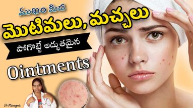 How to Remove Pimples and Acne Sacrs | Best Ointments | PimpleTreatment | Smooth and Glowing Face | 18 1687206401 maxresdefault