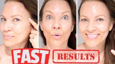 FAST RESULTS w/ this NEW HYPERPIGMENTATION TREATMENT! Do this AT HOME!!! Dr Recommended! 6 1687338737 maxresdefault