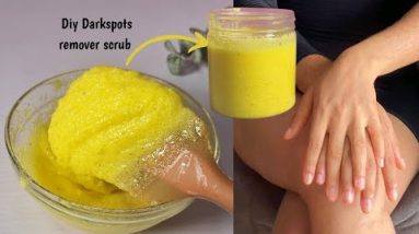 This will Lighten Darkspots, Dull Skin, Dark armpit, bikini areas & Clear Bumpy Skin FAST ! 20 1687349794 hqdefault