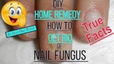 DIY Fingernail Fungus Treatment- Home Remedy - Please read the description 10 1687368137 hqdefault
