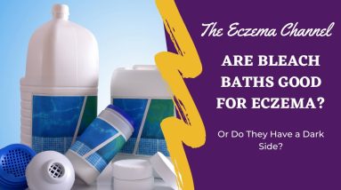 Are Bleach Baths Good For Eczema? 2 1687382861 maxresdefault