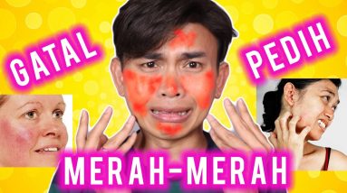 CARA NAK JAGA KULIT SENSITIF 10 1687452427 maxresdefault