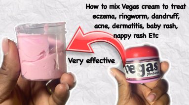 How to mix Vegas cream for skin infection- very effective. 6 1687615728 maxresdefault