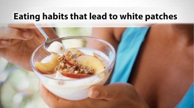 Eating habits that lead to white patches 10 1687690256 maxresdefault