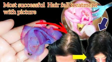 बनाये प्याज़ का तेल आसान तरीके से | MAKE ONION HAIR OIL for faster hair growth and stop hair fall 6 1687692668 hqdefault