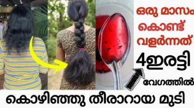 (ഒരു തുള്ളി തലയിൽ തലയിൽ തട്ടിയാൽ മതി) കൊഴിഞ്ഞു തീരാറായ മുടിപോലും 4മടങ്ങ് speed ആയി വളരും 4 1687696306 hqdefault