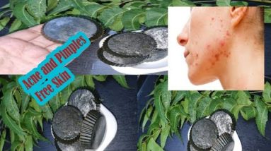 Home made neem soap for acne free , bright and clean skin 6 1687729475 hqdefault