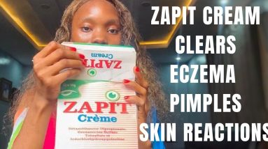 ZAPIT Cream: Say Goodbye to Eczema and Pimples 10 1687795469 maxresdefault