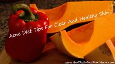 Acne Diet Tips For Clear And Healthy Skin 14 1687952116 hqdefault