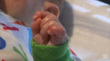 Mayo Clinic Minute: Protecting babies from eczema risk 16 1688242911 maxresdefault