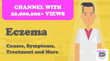 Eczema - Causes, Symptoms, Treatment and More 12 1688250324 maxresdefault