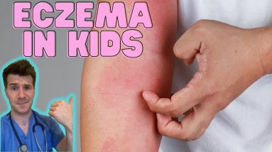Everything you need to know about Eczema in kids! Causes, symptoms, treatment & home management 10 1688254011 maxresdefault