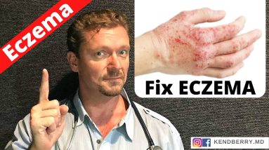 Is this Causing Your ECZEMA? (Easy Way to Tell) 2023 8 1688294349 maxresdefault
