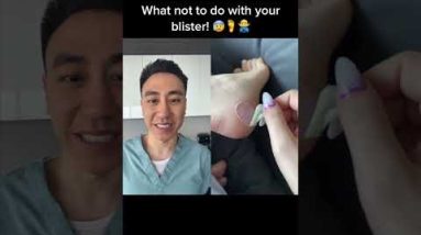 WHAT NOT TO DO WITH YOUR BLISTER! 4 1688301740 hqdefault