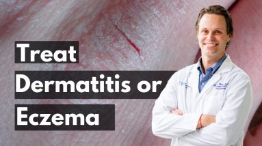 How to Treat Hand Dermatitis or Eczema | Chet Tharpe MD 16 1688316421 maxresdefault