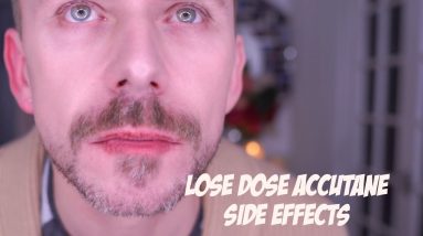 I STARTED TAKING LOW DOSE ACCUTANE! 14 1688327398 maxresdefault