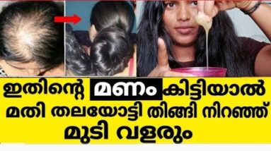 കൊഴിഞ്ഞു തീരാറായ മുടി ഒരു മാസം കൊണ്ട് വളർന്നത് 4ഇരട്ടി വേഗത്തിൽ(തെളിവ് സഹിതം) 2 1688405676 hqdefault