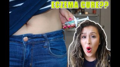NEW CURE FOR ECZEMA!! Dupixent 16 1688416585 maxresdefault