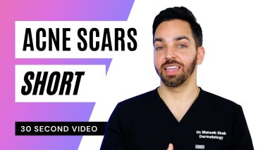 Acne Scars #shorts 4 1688463019 maxresdefault