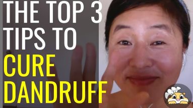 Cure Dandruff - the top 3 tips 4 1688466438 maxresdefault