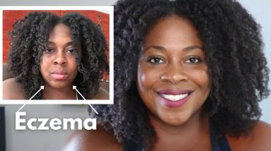 How I care for my Dry, Eczema Prone Skin| Skincare for Face Regimen 2 1688470343 maxresdefault