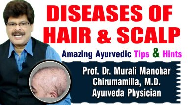 Hair and Scalp Disorders | Prof. Dr. Murali Manohar Chirumamilla, M.D. (Ayurveda) 20 1688473793 maxresdefault