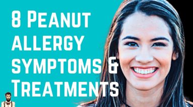 8 Peanut Allergy Symptoms and Treatments – The Root Problem 18 1688477425 maxresdefault