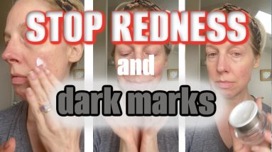 1688479918 maxresdefault