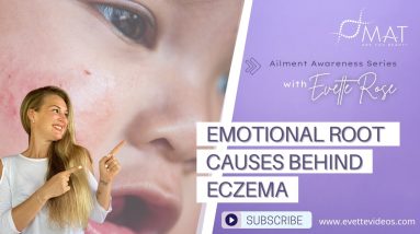 Emotional Root Causes Behind Eczema by Evette Rose - August 2021 2 1688577089 maxresdefault