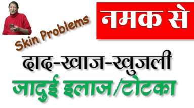 दाद, खाज, खुजली में नमक से तुरंत आराम | Psoriasis, Eczema, Skin Rashes, Blisters etc. Skin Problems 18 1688584400 maxresdefault