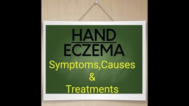 Step-By-Step Relief From Your Embarrassing Hand Eczema! 10 1688599113 maxresdefault